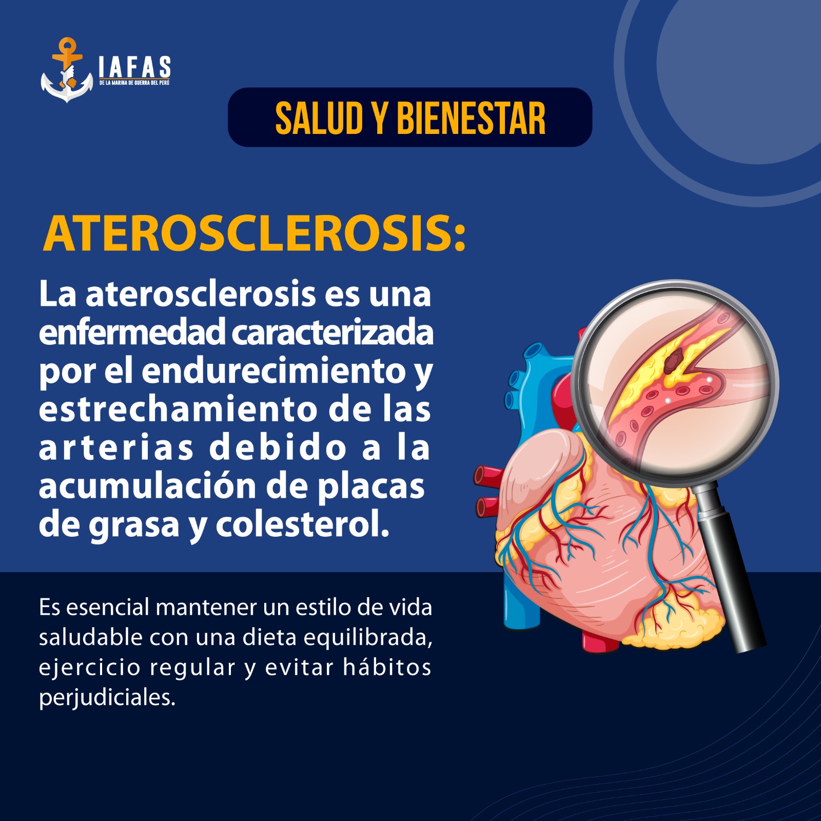 ¿Qué es la aterosclerosis?